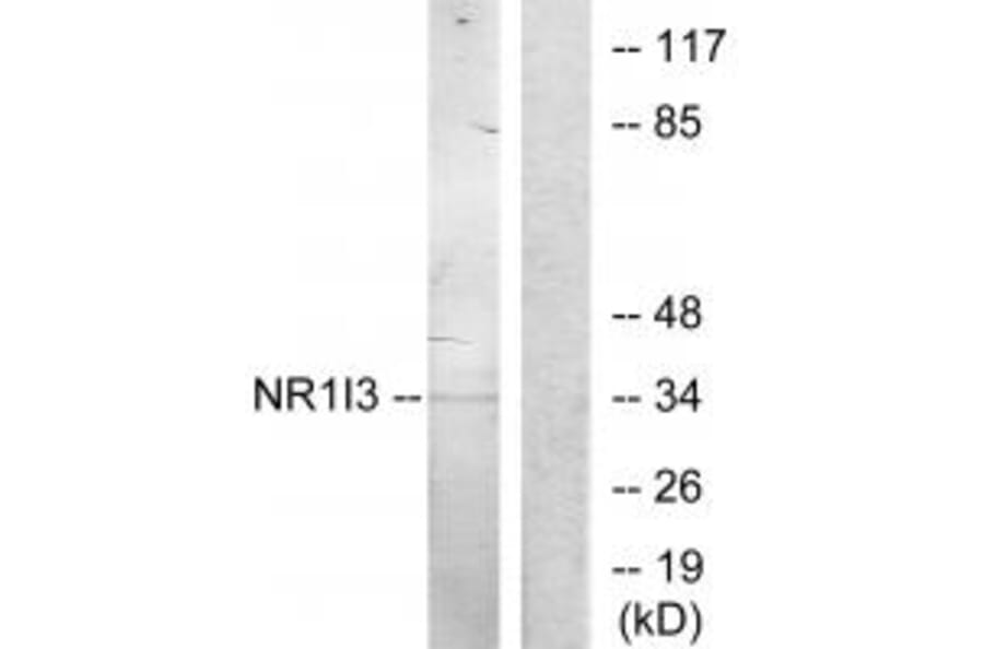 Western blot - NR1I3 Antibody from Signalway Antibody (33887) - Antibodies.com