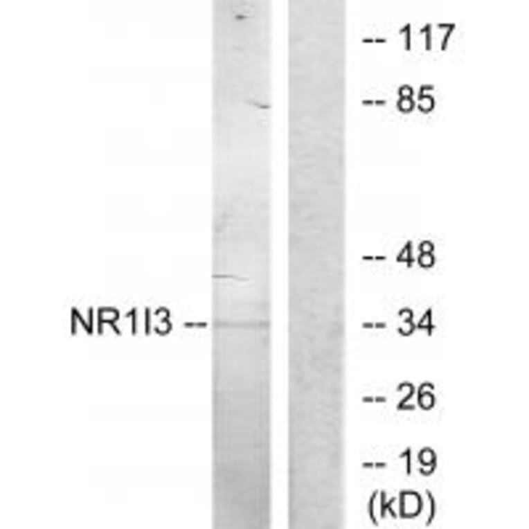 Western blot - NR1I3 Antibody from Signalway Antibody (33887) - Antibodies.com
