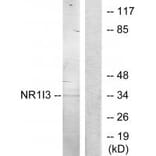 Western blot - NR1I3 Antibody from Signalway Antibody (33887) - Antibodies.com