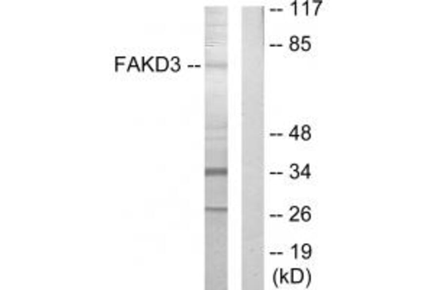 Western blot - FAKD3 Antibody from Signalway Antibody (33888) - Antibodies.com