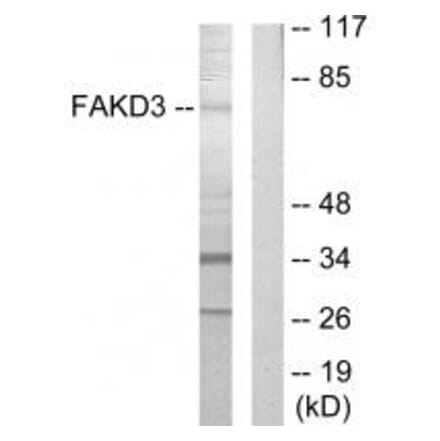 Western blot - FAKD3 Antibody from Signalway Antibody (33888) - Antibodies.com