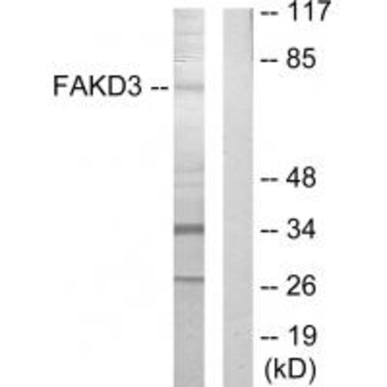 Western blot - FAKD3 Antibody from Signalway Antibody (33888) - Antibodies.com