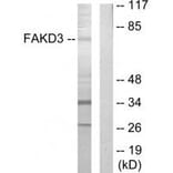 Western blot - FAKD3 Antibody from Signalway Antibody (33888) - Antibodies.com