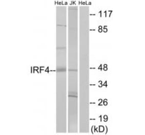 Western blot - IRF4 Antibody from Signalway Antibody (33893) - Antibodies.com