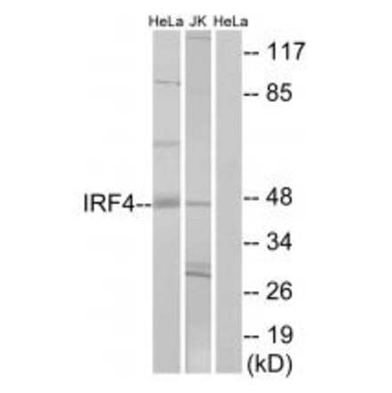 Western blot - IRF4 Antibody from Signalway Antibody (33893) - Antibodies.com