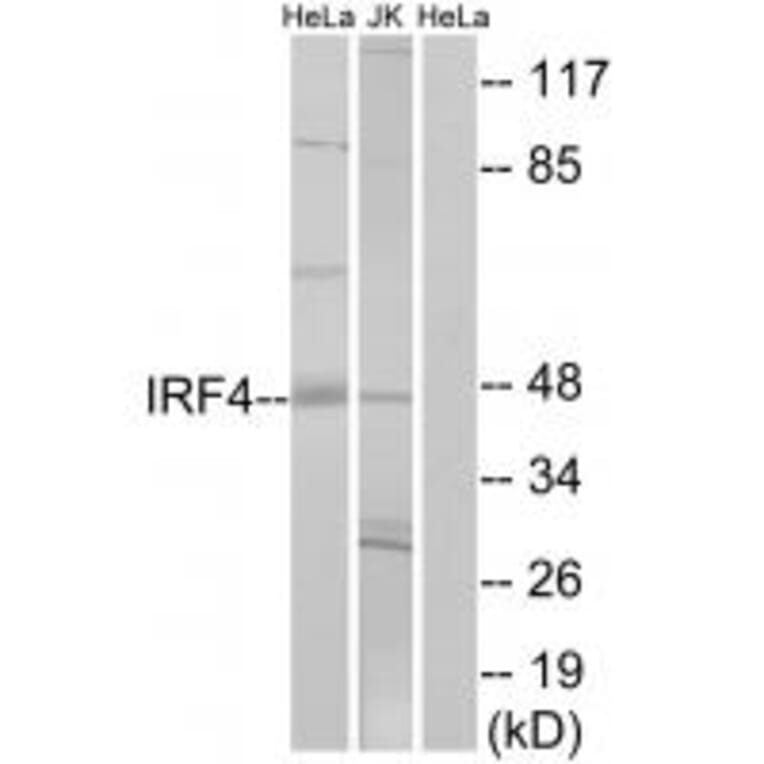 Western blot - IRF4 Antibody from Signalway Antibody (33893) - Antibodies.com