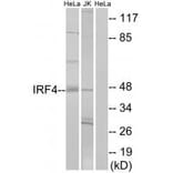 Western blot - IRF4 Antibody from Signalway Antibody (33893) - Antibodies.com