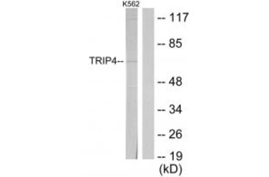 Western blot - TRIP4 Antibody from Signalway Antibody (33903) - Antibodies.com