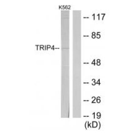 Western blot - TRIP4 Antibody from Signalway Antibody (33903) - Antibodies.com