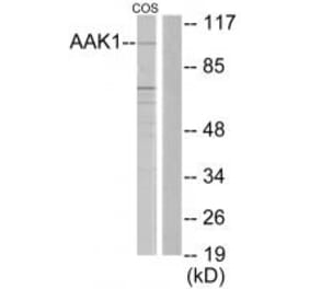 Western blot - AAK1 Antibody from Signalway Antibody (33919) - Antibodies.com