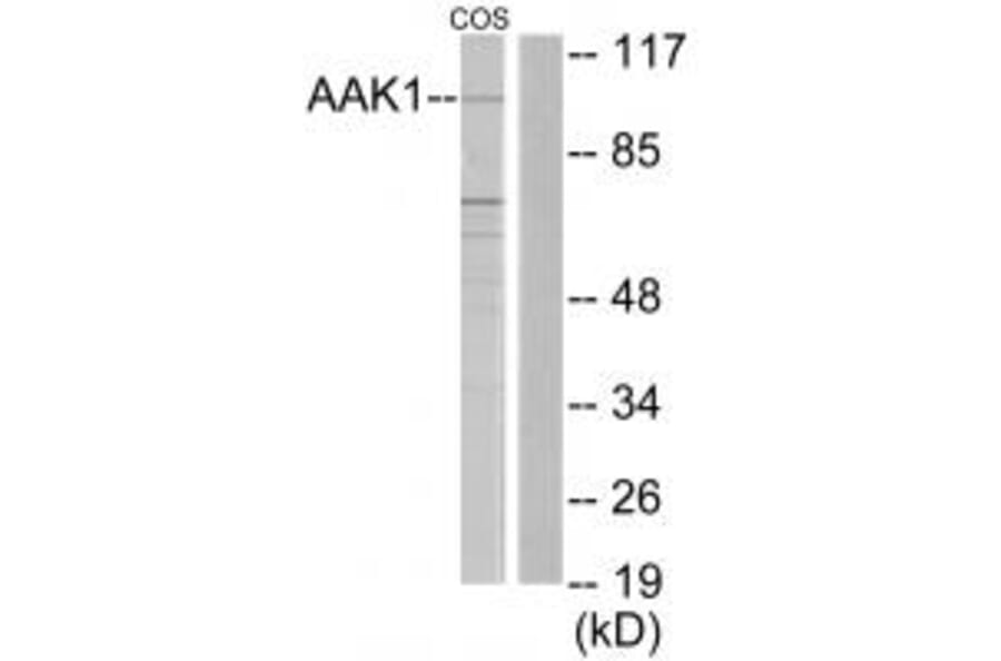 Western blot - AAK1 Antibody from Signalway Antibody (33919) - Antibodies.com