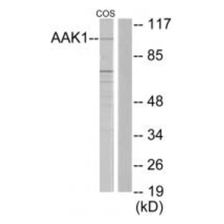 Western blot - AAK1 Antibody from Signalway Antibody (33919) - Antibodies.com