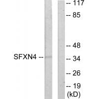 Western blot analysis of extracts from HUVEC cells, using SFXN4 antibody #33937.
