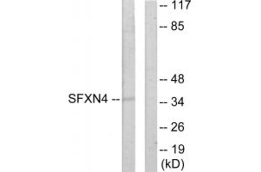 Western blot - SFXN4 Antibody from Signalway Antibody (33937) - Antibodies.com