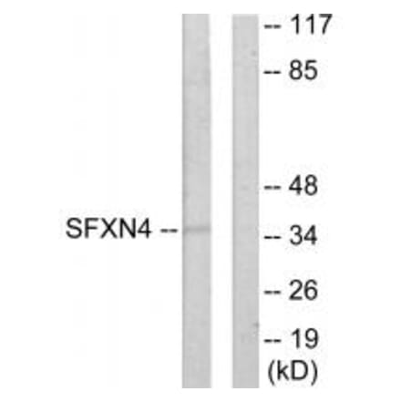 Western blot - SFXN4 Antibody from Signalway Antibody (33937) - Antibodies.com