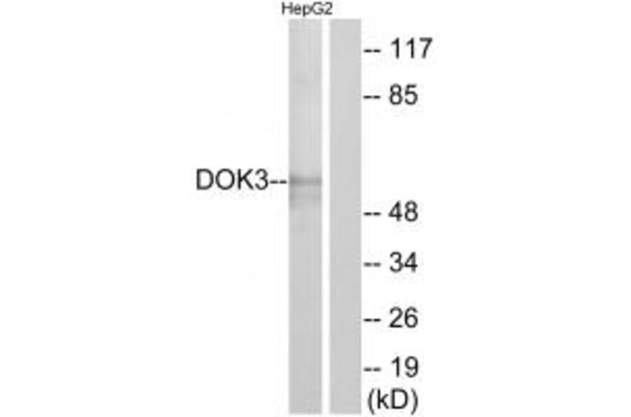 Western blot - DOK3 Antibody from Signalway Antibody (33944) - Antibodies.com
