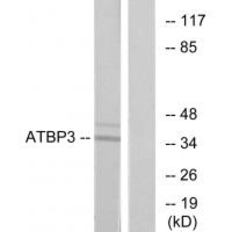 Western blot - ATBP3 Antibody from Signalway Antibody (33949) - Antibodies.com