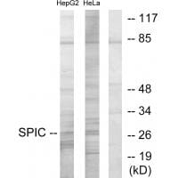 Western blot analysis of extracts from HepG2 cells and HeLa cells, using SPIC antibody #33968.