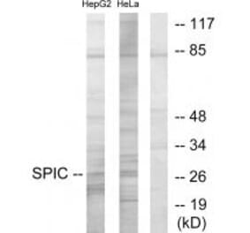 Western blot - SPIC Antibody from Signalway Antibody (33968) - Antibodies.com