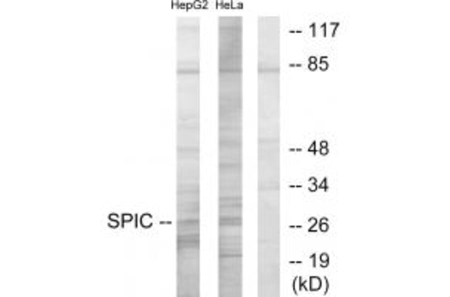 Western blot - SPIC Antibody from Signalway Antibody (33968) - Antibodies.com