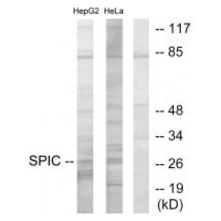 Western blot - SPIC Antibody from Signalway Antibody (33968) - Antibodies.com