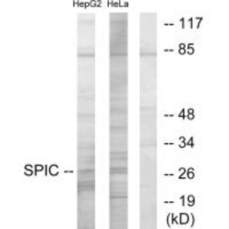 Western blot - SPIC Antibody from Signalway Antibody (33968) - Antibodies.com