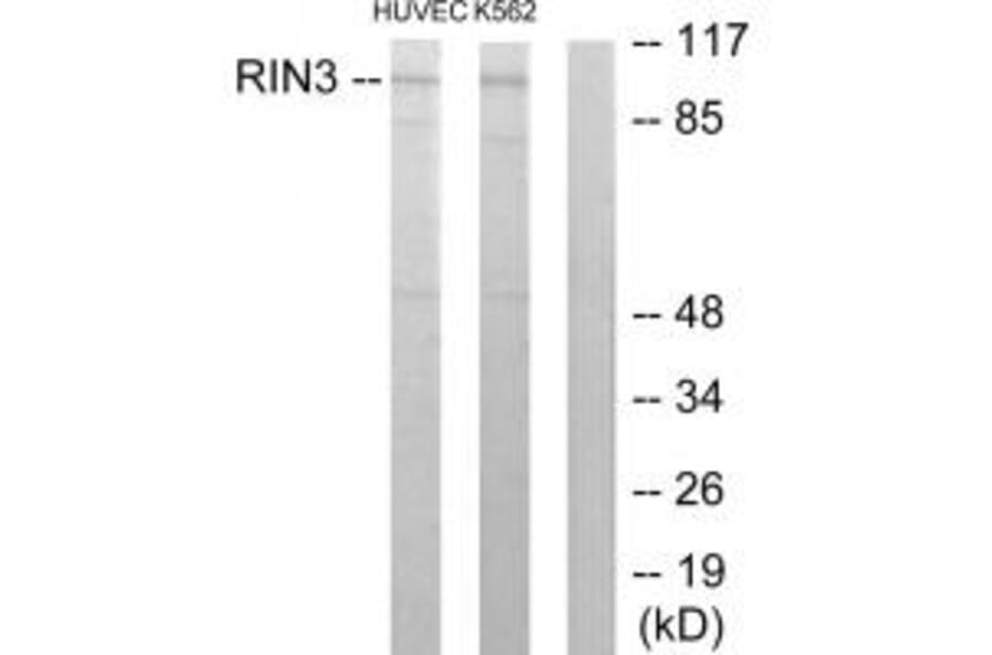Western blot - RIN3 Antibody from Signalway Antibody (33985) - Antibodies.com
