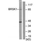 Western blot - BRSK1 Antibody from Signalway Antibody (33989) - Antibodies.com