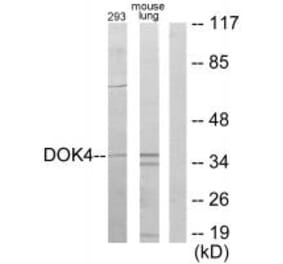 Western blot - DOK4 Antibody from Signalway Antibody (33993) - Antibodies.com