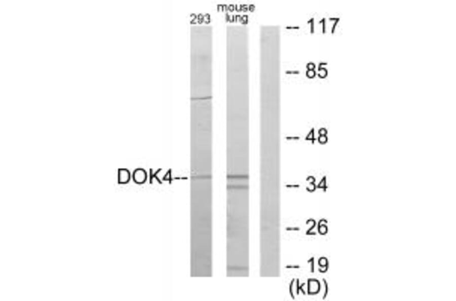 Western blot - DOK4 Antibody from Signalway Antibody (33993) - Antibodies.com
