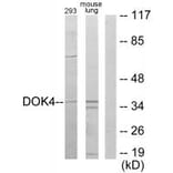 Western blot - DOK4 Antibody from Signalway Antibody (33993) - Antibodies.com