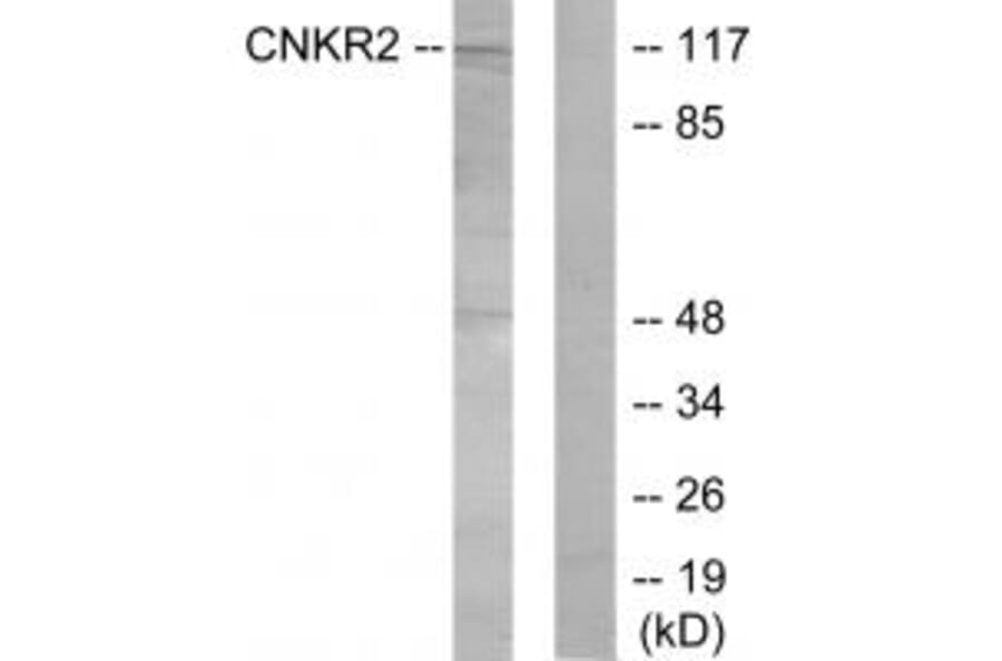 Western blot - CNKR2 Antibody from Signalway Antibody (33998) - Antibodies.com