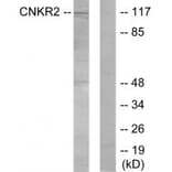 Western blot - CNKR2 Antibody from Signalway Antibody (33998) - Antibodies.com
