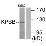 Western blot - KPBB Antibody from Signalway Antibody (34016) - Antibodies.com