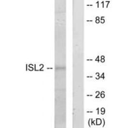 Western blot - ISL2 Antibody from Signalway Antibody (34021) - Antibodies.com