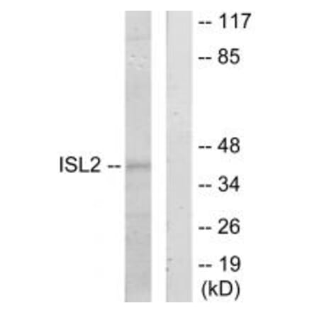 Western blot - ISL2 Antibody from Signalway Antibody (34021) - Antibodies.com