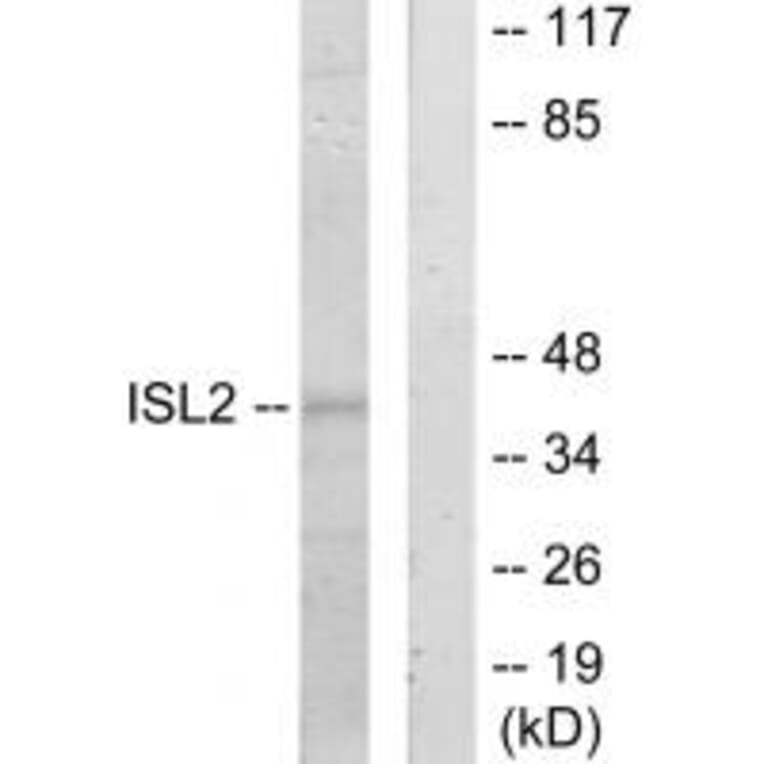 Western blot - ISL2 Antibody from Signalway Antibody (34021) - Antibodies.com