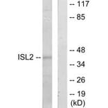 Western blot - ISL2 Antibody from Signalway Antibody (34021) - Antibodies.com