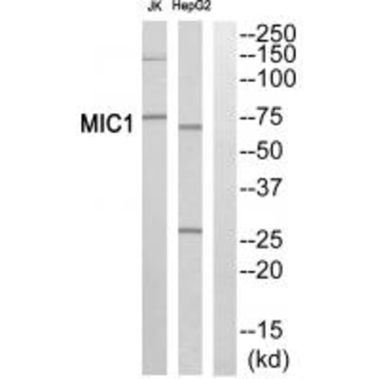 Western blot - MIC1 Antibody from Signalway Antibody (34027) - Antibodies.com
