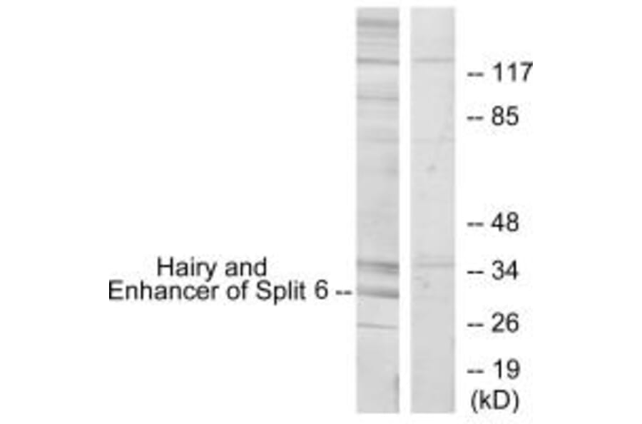 Western blot - HES6 Antibody from Signalway Antibody (34030) - Antibodies.com