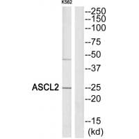 Western blot analysis of extracts from K562 cells, using ASCL2 antibody #34038.