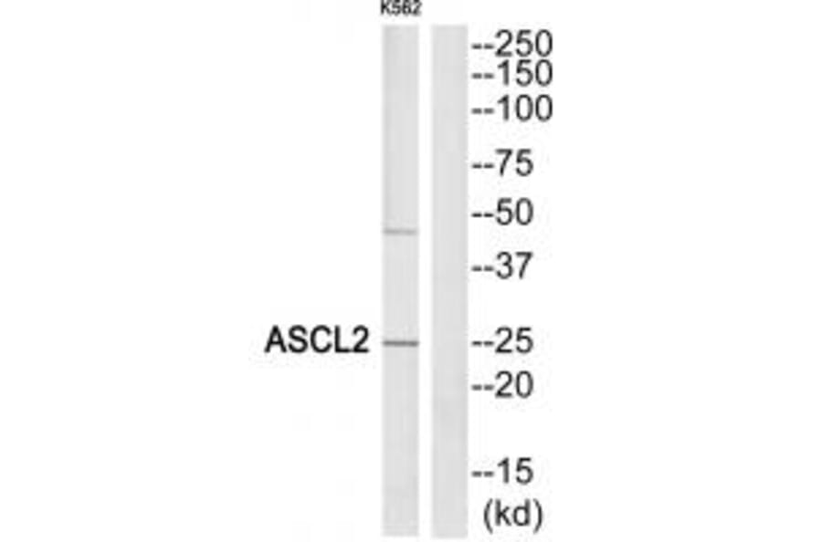 Western blot - ASCL2 Antibody from Signalway Antibody (34038) - Antibodies.com