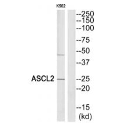 Western blot - ASCL2 Antibody from Signalway Antibody (34038) - Antibodies.com