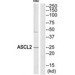 Western blot - ASCL2 Antibody from Signalway Antibody (34038) - Antibodies.com