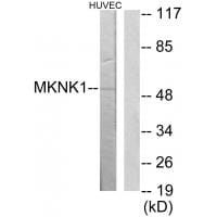 Western blot analysis of extracts from HuvEc cells, using MKNK1 antibody #34046.