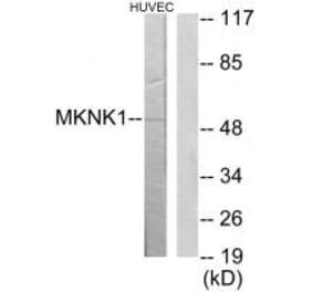 Western blot - MKNK1 Antibody from Signalway Antibody (34046) - Antibodies.com