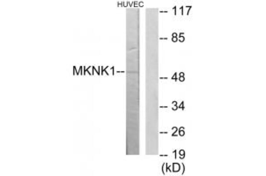 Western blot - MKNK1 Antibody from Signalway Antibody (34046) - Antibodies.com