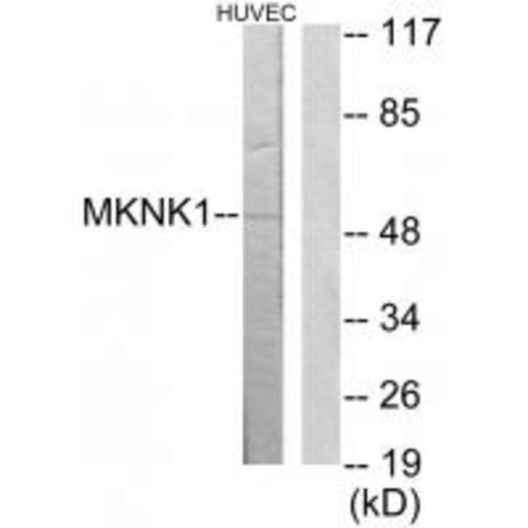 Western blot - MKNK1 Antibody from Signalway Antibody (34046) - Antibodies.com