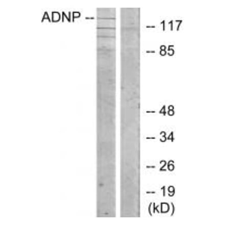 Western blot - ADNP Antibody from Signalway Antibody (34061) - Antibodies.com