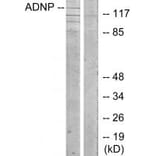 Western blot - ADNP Antibody from Signalway Antibody (34061) - Antibodies.com